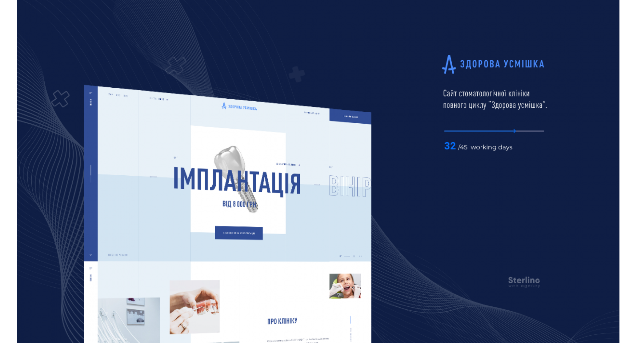 Stearling Agency